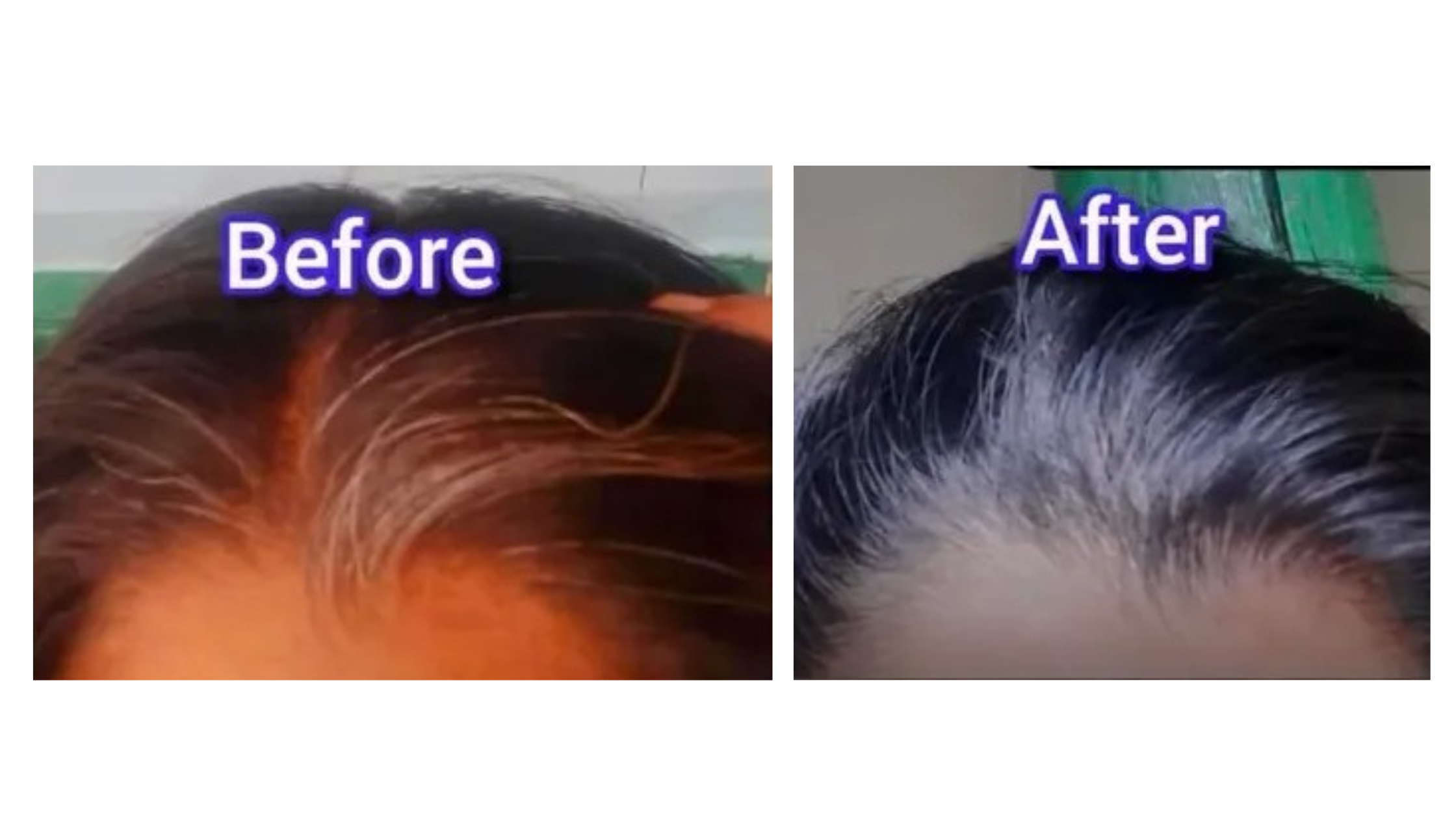 Before After 1