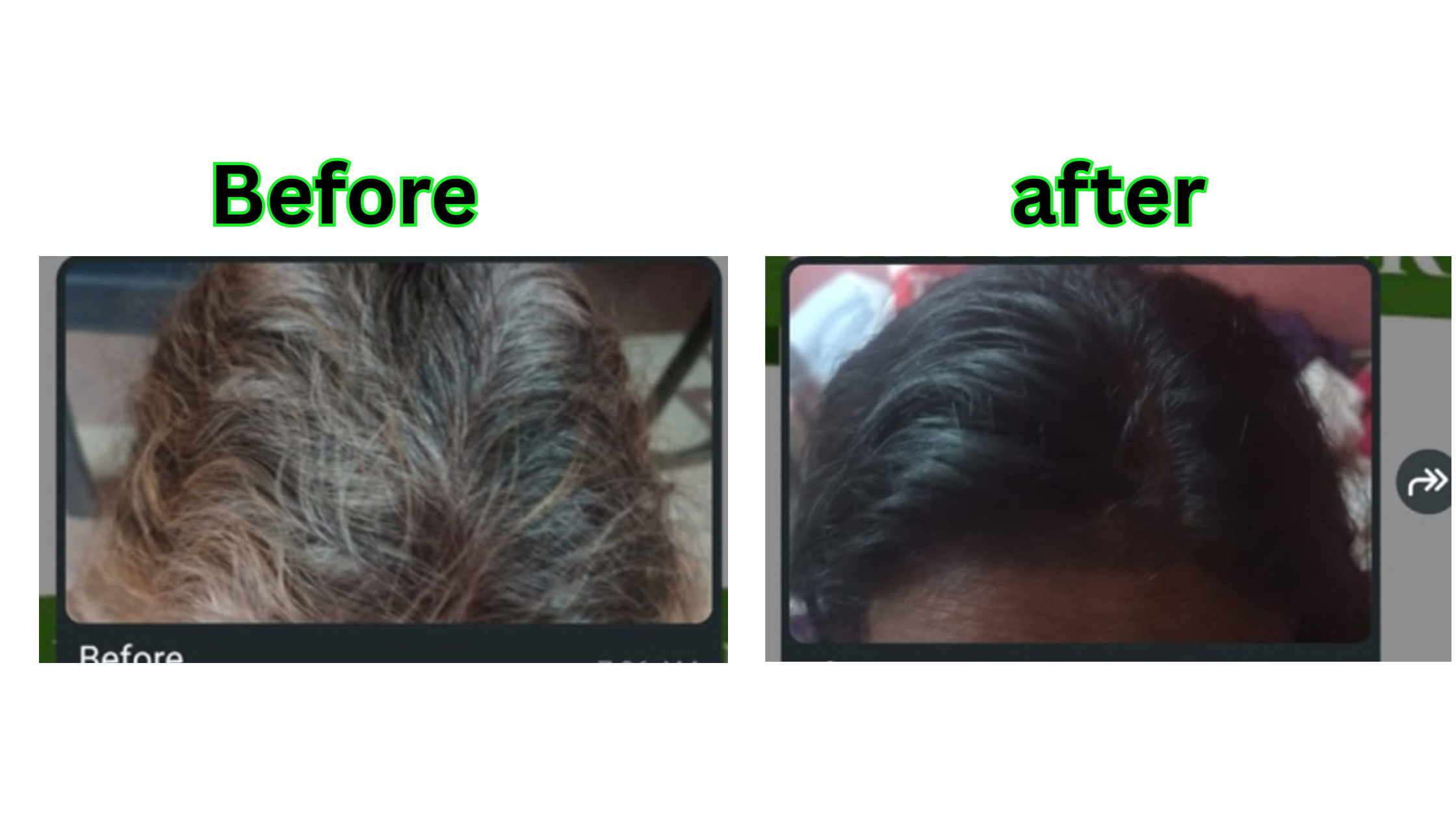 Before After 3