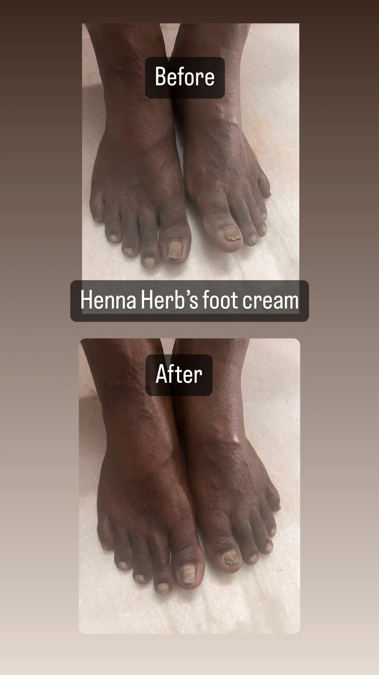 Foot Cream
