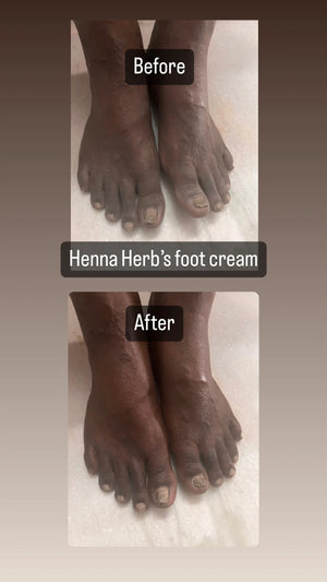 Foot Cream