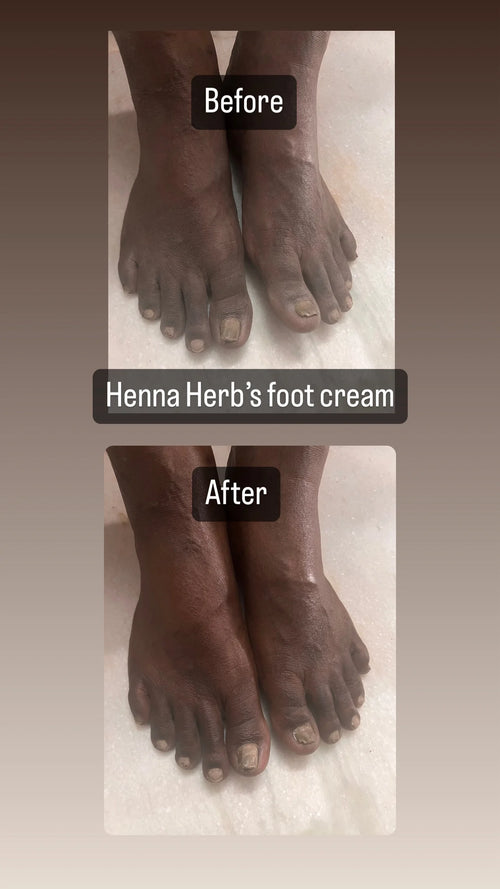 Foot Cream