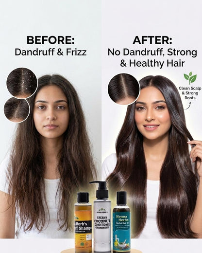bye bye dandruff kit