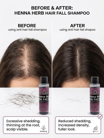 ANTI HAIRFALL SHAMPOO