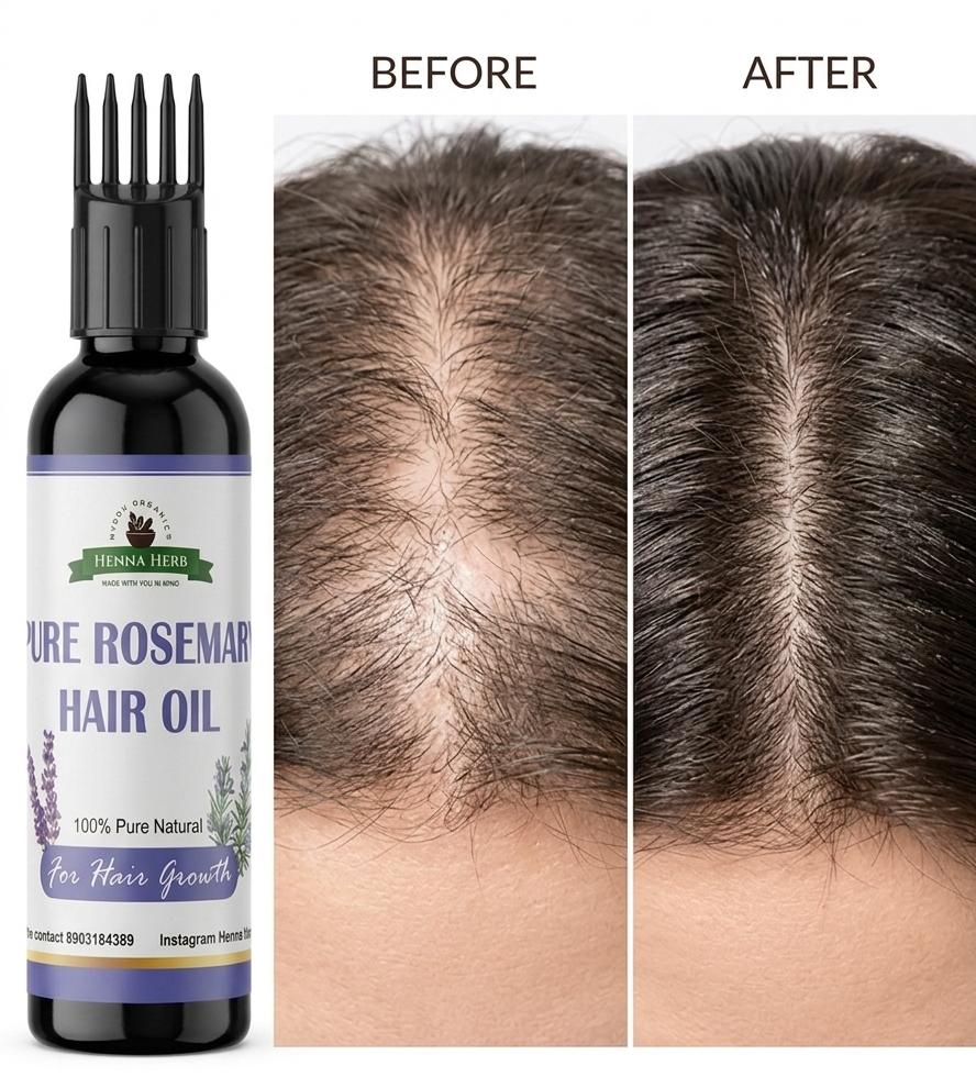 PURE ROSEMARY HAIR OIL