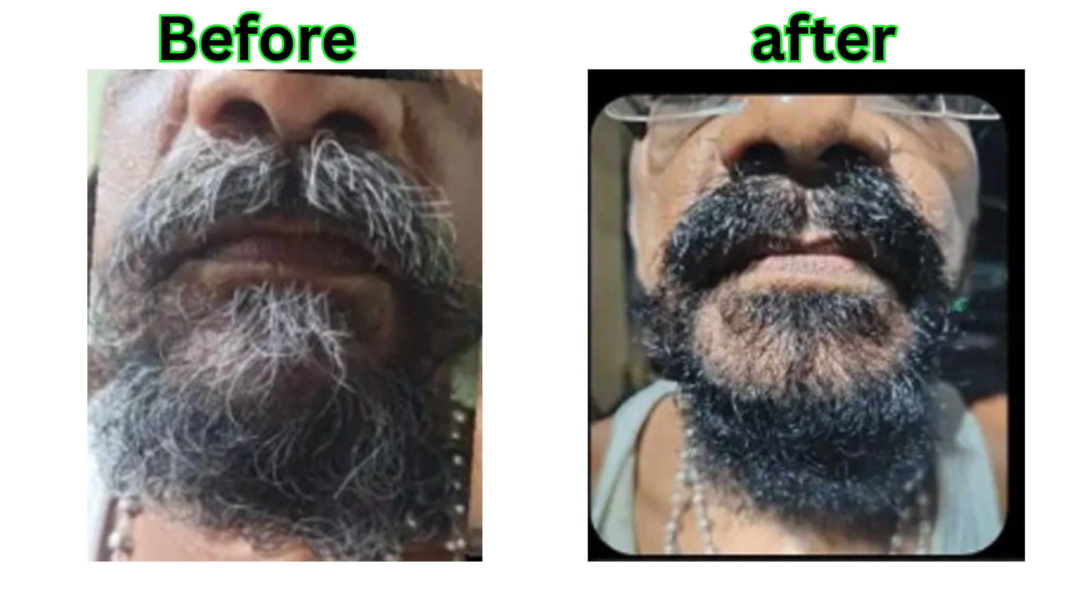 Before After 2