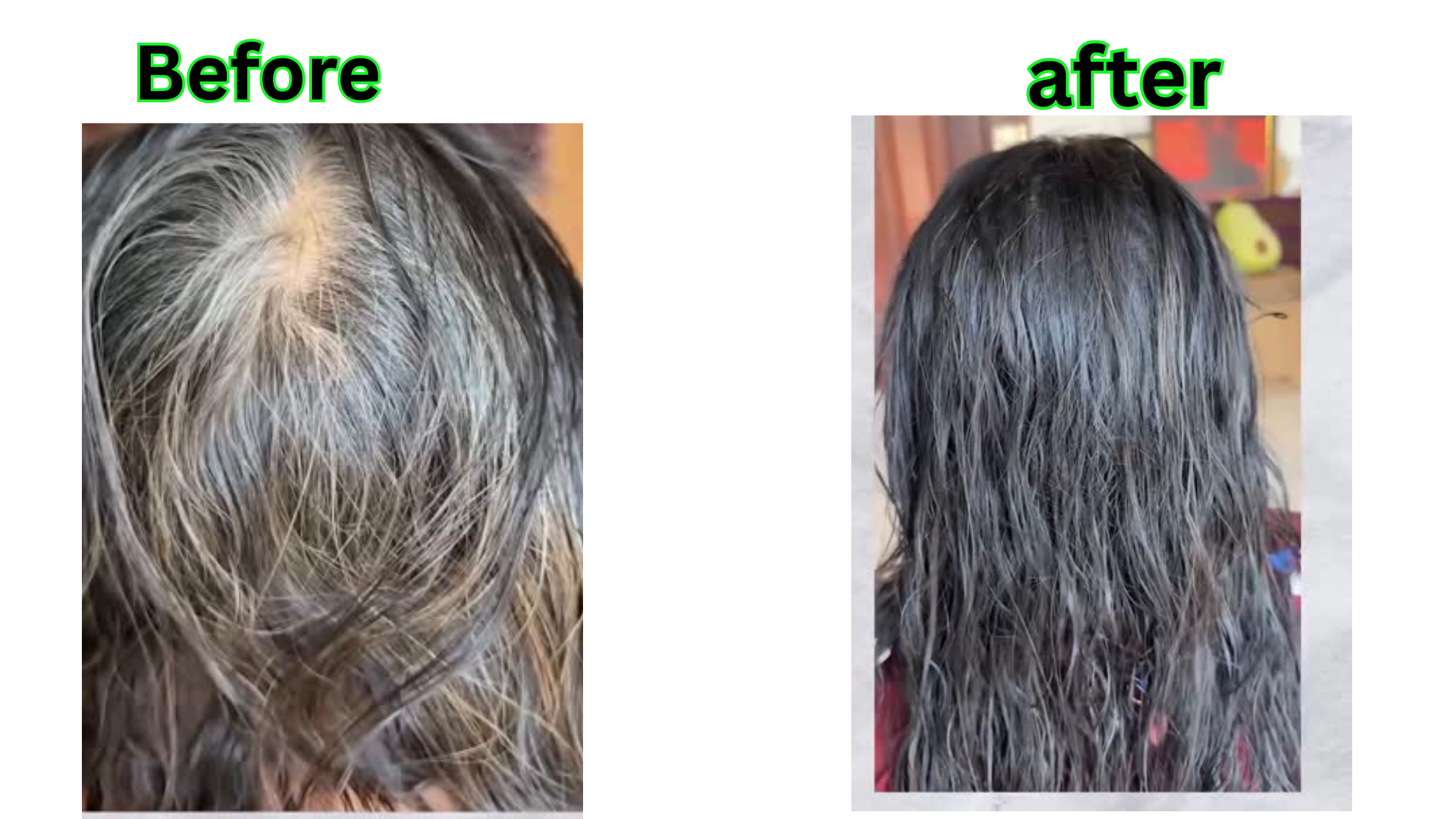 Before After 4